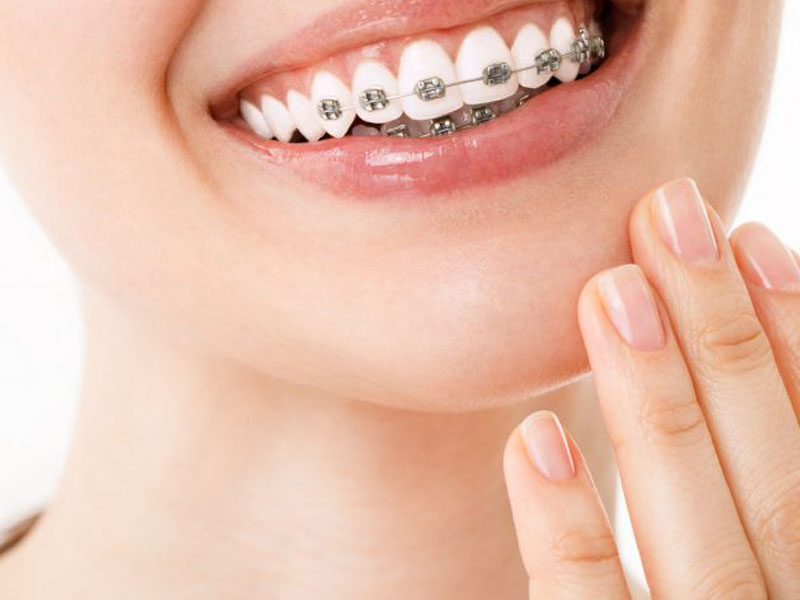 Recomendaciones tras la ortodoncia